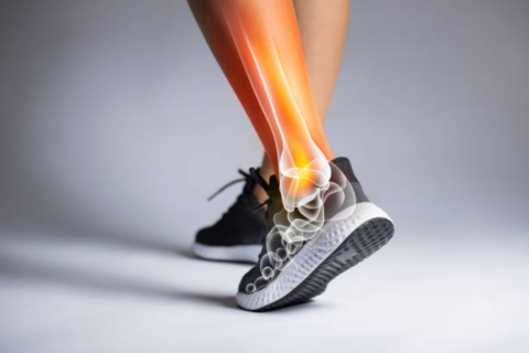talonnettes douleurs pied et jambes